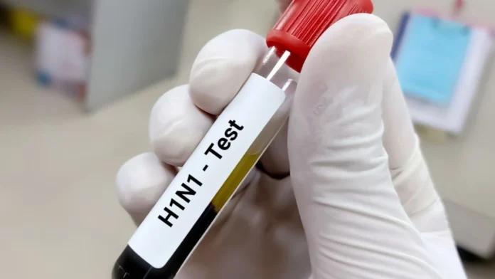 H1N1 test